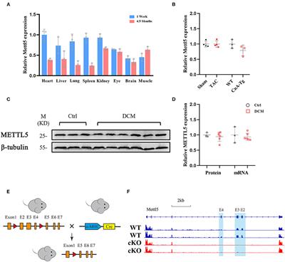 Loss of m6A Methyltransferase METTL5 Promotes Cardiac Hypertrophy Through Epitranscriptomic Control of SUZ12 Expression